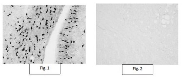 Anti-Aspa/Nur7-Antikörper from rabbit, purified by affinity chromatography