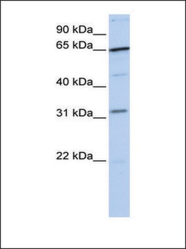 Anti-SRPR antibody produced in rabbit affinity isolated antibody