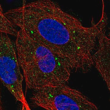 Anty-SCARB1 Prestige Antibodies&#174; Powered by Atlas Antibodies, affinity isolated antibody, buffered aqueous glycerol solution