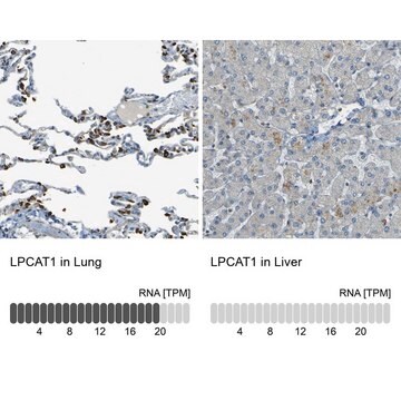 Anti-LPCAT1 antibody produced in rabbit Prestige Antibodies&#174; Powered by Atlas Antibodies, affinity isolated antibody, buffered aqueous glycerol solution, Ab1