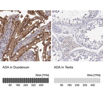 抗-ADA 兔抗 Prestige Antibodies&#174; Powered by Atlas Antibodies, affinity isolated antibody, buffered aqueous glycerol solution