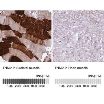 Anti-TNNI2 antibody produced in rabbit Prestige Antibodies&#174; Powered by Atlas Antibodies, affinity isolated antibody, buffered aqueous glycerol solution