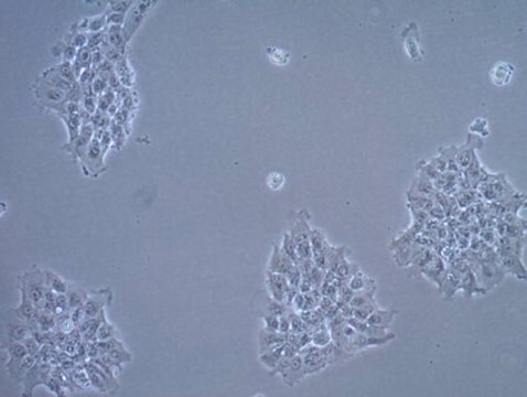 Plattenepithelzellkarzinom-Zelllinie UM-SCC-17A UM-SCC-17A is a unique head and neck squamous carcinoma cell line isolated from the primary laryngeal carcinoma of a 48-year old female patient who failed to respond to radiation therapy and is a suitable in vitro model of H&amp;N carcinoma studies.