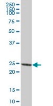 Anti-PRTN3 antibody produced in mouse purified immunoglobulin, buffered aqueous solution