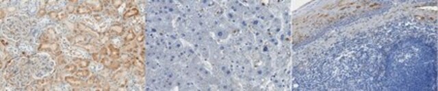 Anti-Complement C3a/C3a (desArg) Antibody, clone K13/16 clone K13/16, from mouse