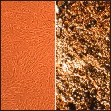 Human Osteoblasts: HOb, fetal