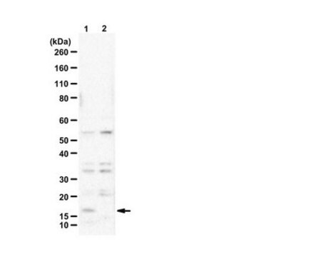 Anty-histon H3.3 G34W from rabbit