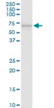 抗-SLC40A1 兔抗 purified immunoglobulin, buffered aqueous solution