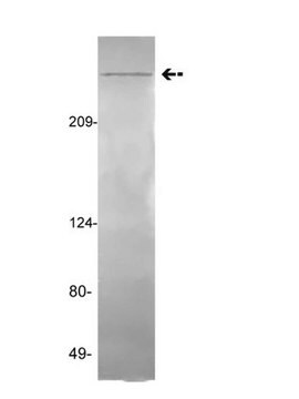 Anti-VWF(Von-Willebrand-Faktor)-Antikörper, Klon GMA-022 clone GMA-022, Upstate&#174;, from mouse