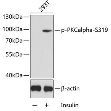 Anti-Phospho-PKCalpha-S319 antibody produced in rabbit