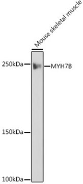 Anti-MYH7B Antibody, clone 7W8J3, Rabbit Monoclonal