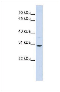 抗SLC25A20抗体 ウサギ宿主抗体 affinity isolated antibody