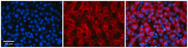 抗RARA抗体 ウサギ宿主抗体 affinity isolated antibody