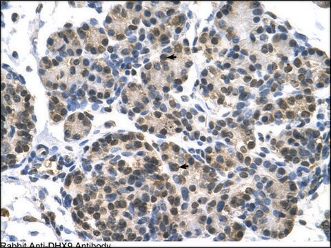 Anti-DHX9 antibody produced in rabbit affinity isolated antibody