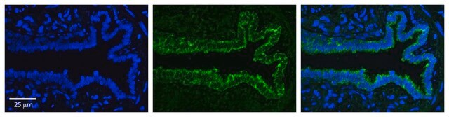 Anti-SerPINE1 (AB1) antibody produced in rabbit affinity isolated antibody