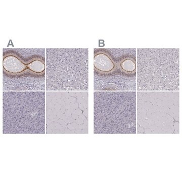 Anti-ZNF185 antibody produced in rabbit Ab1, Prestige Antibodies&#174; Powered by Atlas Antibodies, affinity isolated antibody, buffered aqueous glycerol solution