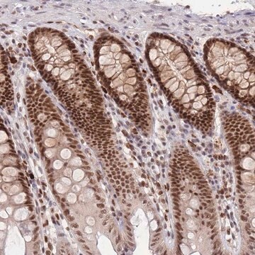 Anti-SMAD9 antibody produced in rabbit Prestige Antibodies&#174; Powered by Atlas Antibodies, affinity isolated antibody, buffered aqueous glycerol solution