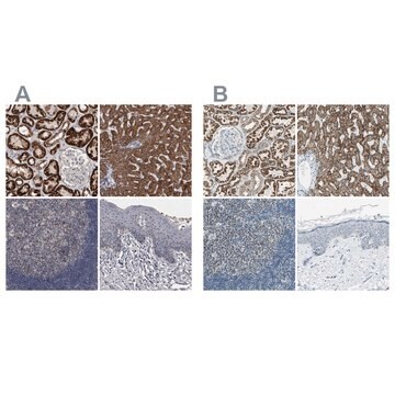 Anti-ACADM antibody produced in rabbit Prestige Antibodies&#174; Powered by Atlas Antibodies, affinity isolated antibody, buffered aqueous glycerol solution