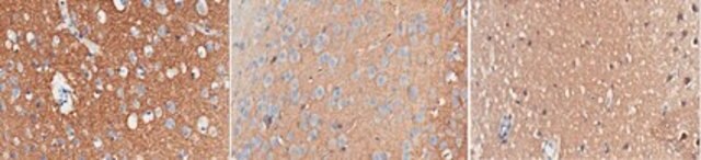 Anti-Synapsin-1 Antibody, clone 10.22 clone 10.22, from mouse