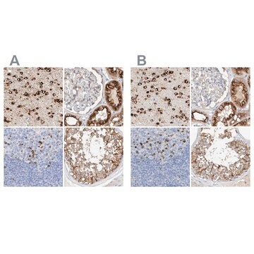 Anti-MAP7 antibody produced in rabbit Prestige Antibodies&#174; Powered by Atlas Antibodies, affinity isolated antibody, buffered aqueous glycerol solution, ab2