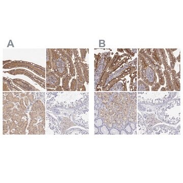 Anti-ADA antibody produced in rabbit Prestige Antibodies&#174; Powered by Atlas Antibodies, affinity isolated antibody, buffered aqueous glycerol solution