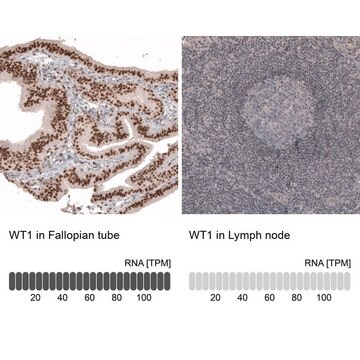 Przeciwciało anty-WT1 produkowane u myszy Prestige Antibodies&#174; Powered by Atlas Antibodies, clone CL13165, purified by using Protein A, buffered aqueous glycerol solution