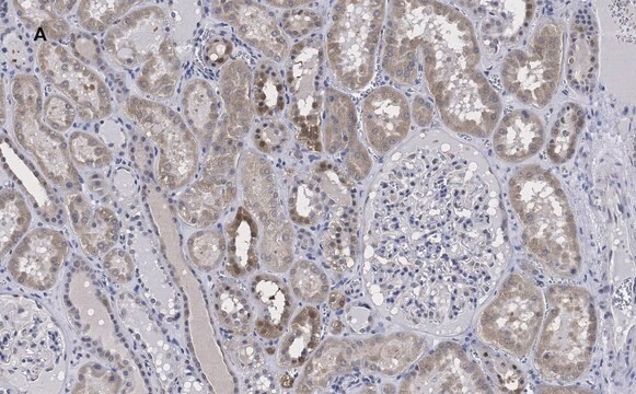 抗FADD抗体 クローン11N7 ZooMAb&#174;ウサギモノクローナル recombinant, expressed in HEK 293 cells