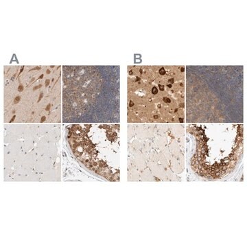 Anti-EIF4G3 antibody produced in rabbit Prestige Antibodies&#174; Powered by Atlas Antibodies, affinity isolated antibody, buffered aqueous glycerol solution, Ab1