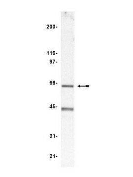 Anti-p67-phox Antibody serum, Upstate&#174;