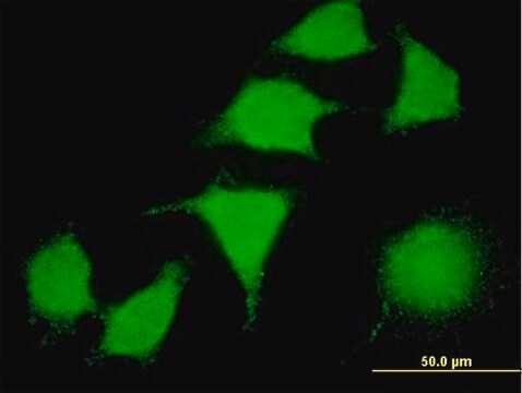 Monoclonal Anti-LIMK2 antibody produced in mouse clone 2H2-E11, purified immunoglobulin, buffered aqueous solution