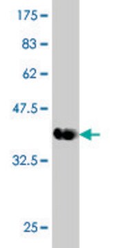 Monoclonal Anti-DYRK1A antibody produced in mouse clone 7D10, purified immunoglobulin, buffered aqueous solution