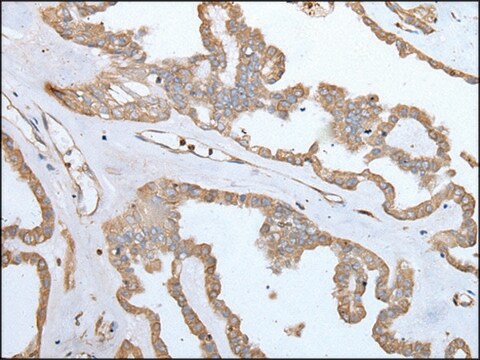 Anti-SPTA1 affinity isolated antibody