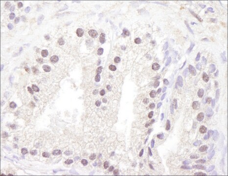 Rabbit anti-ATM Antibody, Affinity Purified Powered by Bethyl Laboratories, Inc.