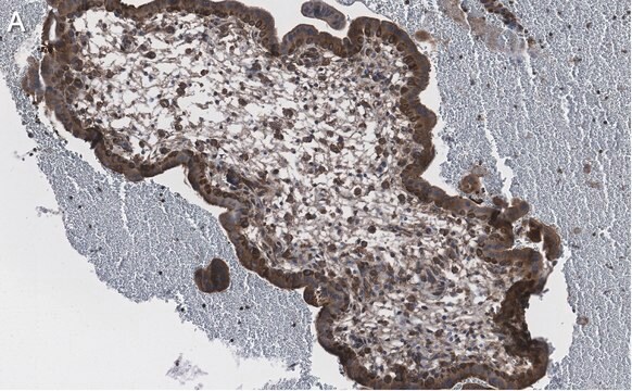 Anti-NF-kB p65 subunit Antibody, clone 1D8 ZooMAb&#174; Rabbit Monoclonal recombinant, expressed in HEK 293 cells