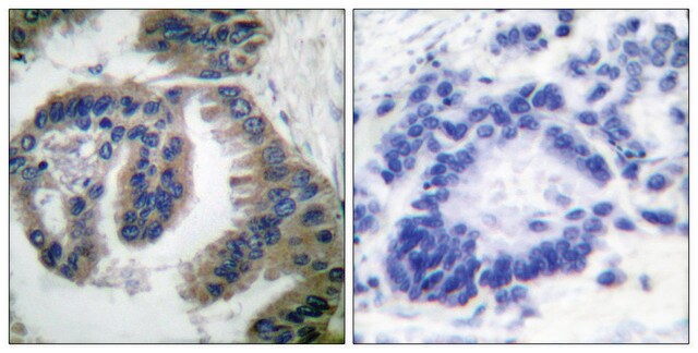 Anti-HSP40 antibody produced in rabbit affinity isolated antibody