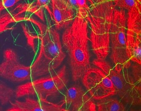 Anticorps anti-neurofilament H Chemicon&#174;, from chicken