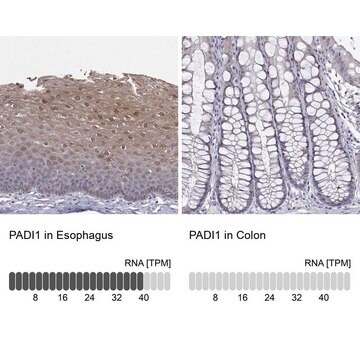 Anti-PADI1 antibody produced in rabbit Prestige Antibodies&#174; Powered by Atlas Antibodies, affinity isolated antibody, buffered aqueous glycerol solution