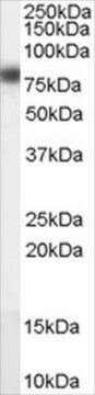 Anti-CPT1A antibody produced in goat affinity isolated antibody, buffered aqueous solution