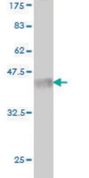 Monoclonal Anti-LRRFIP1 antibody produced in mouse clone 4E11, purified immunoglobulin, buffered aqueous solution