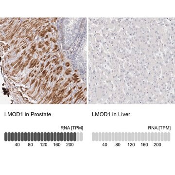 抗LMOD1抗体 ウサギ宿主抗体 Prestige Antibodies&#174; Powered by Atlas Antibodies, affinity isolated antibody, buffered aqueous glycerol solution, ab1