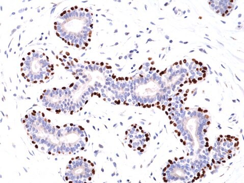 Przeciwciało monoklonalne królicze anty-p63(białko nowotworowe 63) clone RM383, affinity purified immunoglobulin