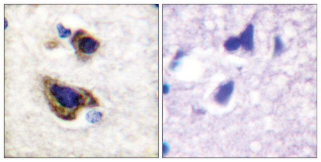 Anti-GFAP antibody produced in rabbit affinity isolated antibody