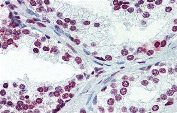 抗ARID5A抗体(ab2) ウサギ宿主抗体 affinity isolated antibody