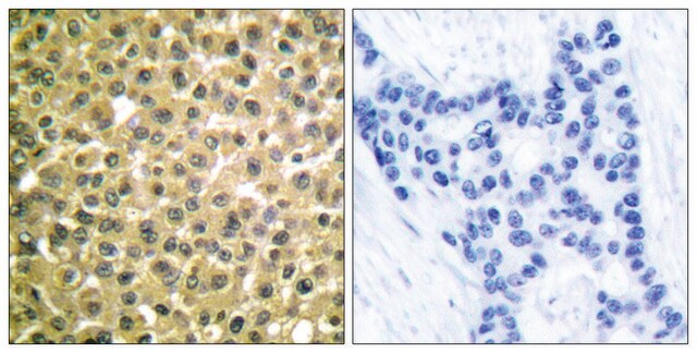 抗-视黄酸受体&#946;，C-末端 兔抗 affinity isolated antibody