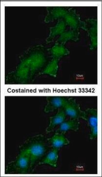 Anti-ATP6AP2 antibody produced in rabbit