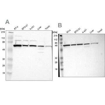 抗CKAP4抗体 ウサギ宿主抗体 Prestige Antibodies&#174; Powered by Atlas Antibodies, affinity isolated antibody