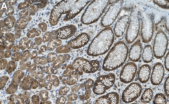 Anti-IDE Antibody, clone 1J8 ZooMAb&#174; Rabbit Monoclonal recombinant, expressed in HEK 293 cells