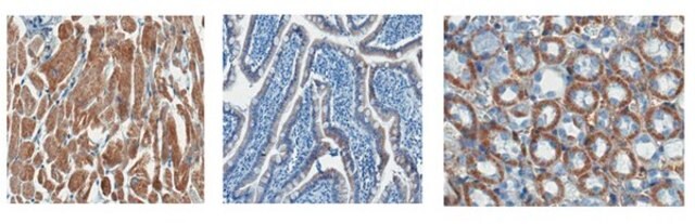 Anti-SDHB Antibody, clone 10C5.1 clone 10C5.1, from mouse