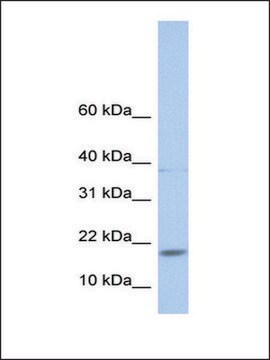 抗MAX抗体 ウサギ宿主抗体 affinity isolated antibody