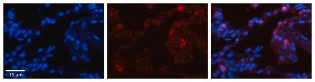 抗GPX3抗体 ウサギ宿主抗体 affinity isolated antibody